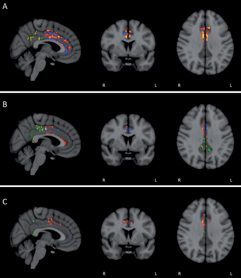 Fig.11