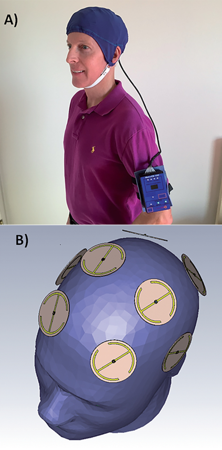 Fig.1