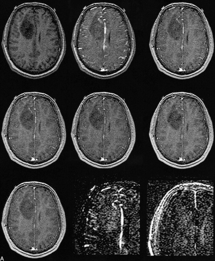 fig 2.