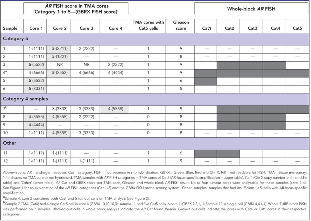 graphic file with name bjc201413t1.jpg