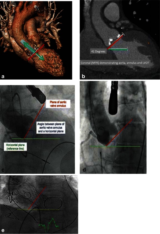 Fig. 20