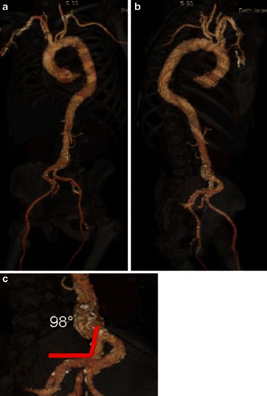 Fig. 22