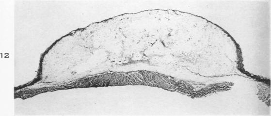 Fig. 12