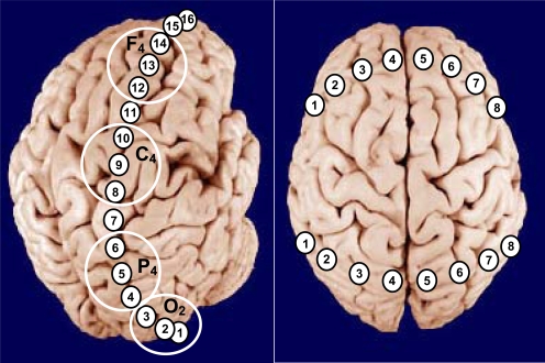 Fig. (9)