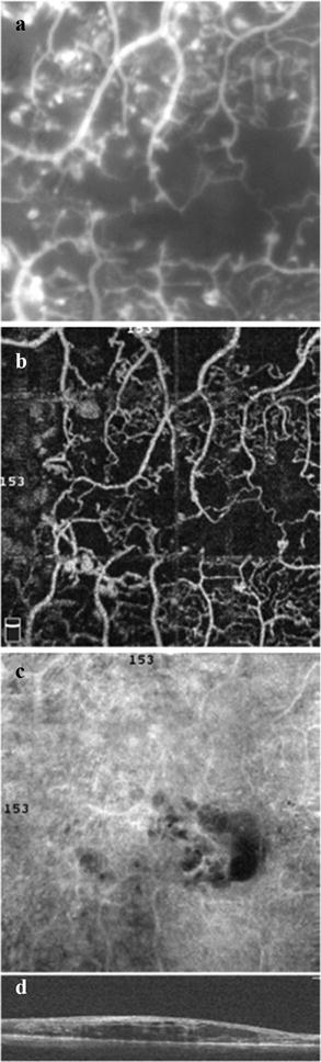 Fig. 6