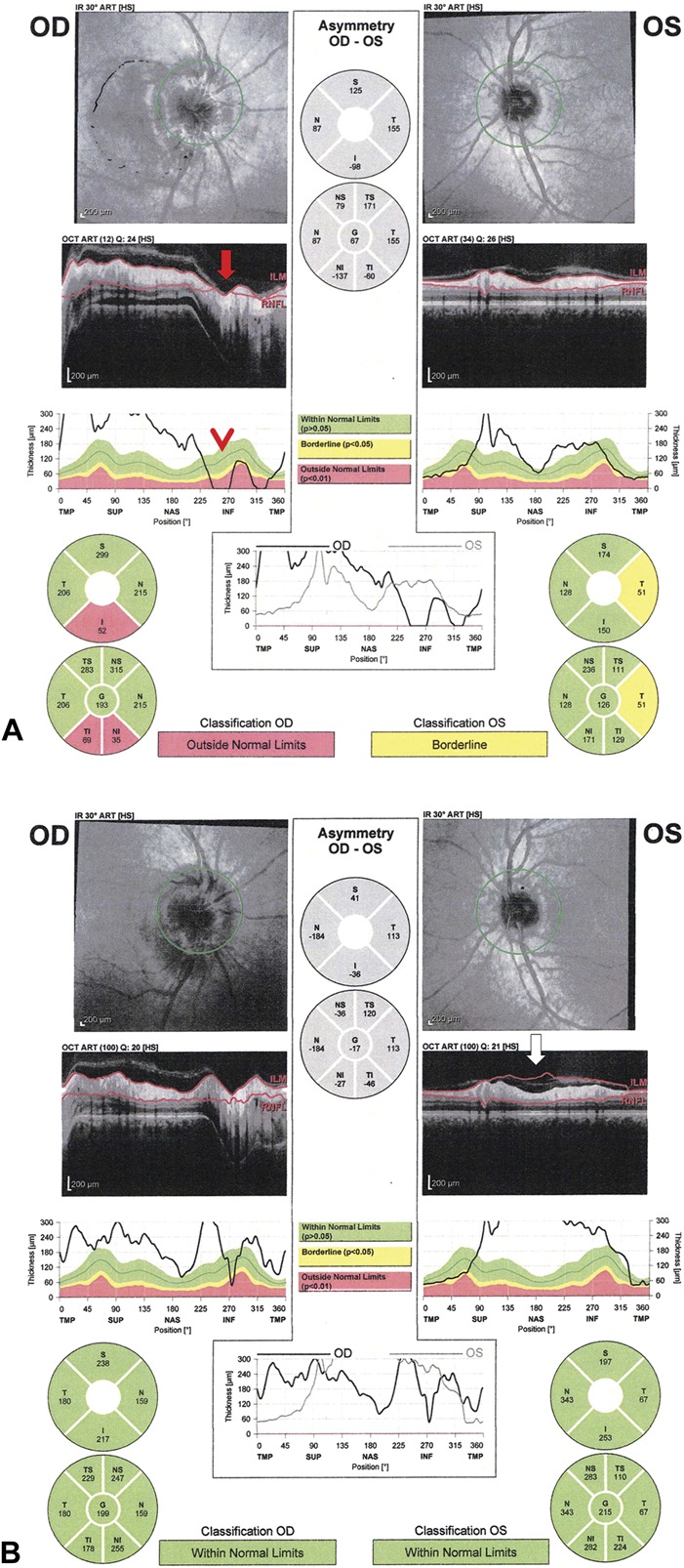 FIG. 4.