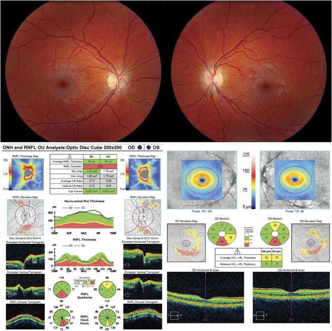 FIG. 3.