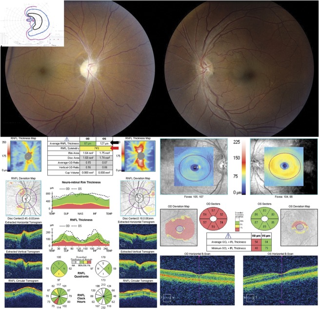 FIG. 10.