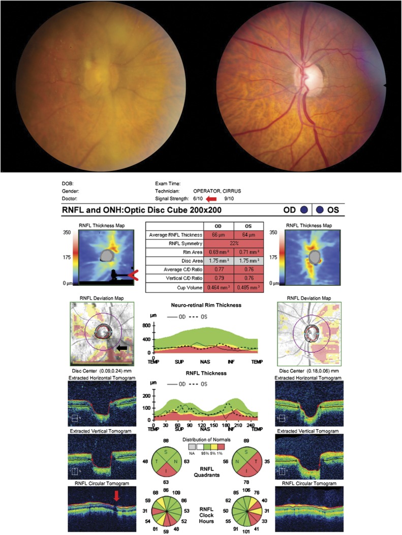 FIG. 1.