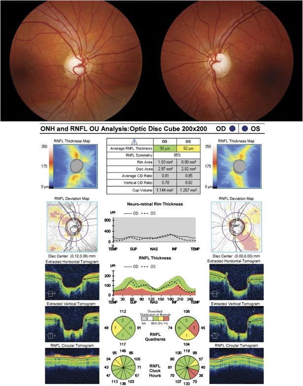 FIG. 12.