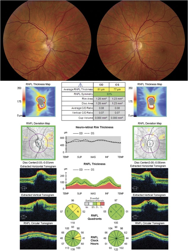 FIG. 11.