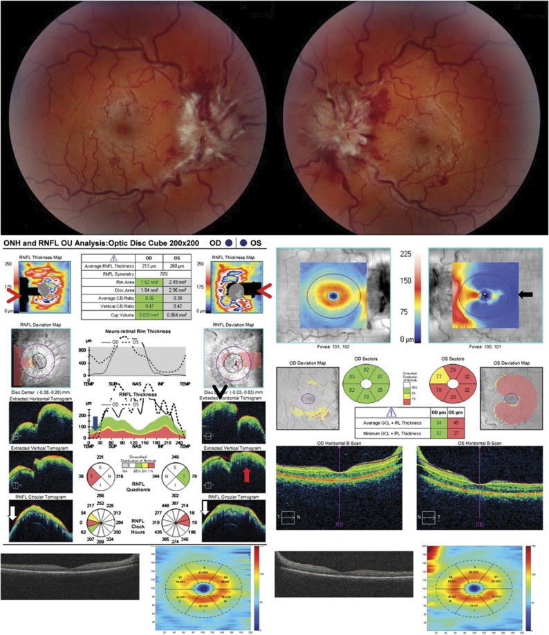 FIG. 2.