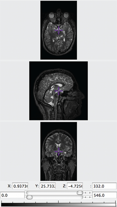 Figure 5