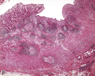 Figure 9-19.