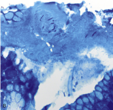 Figure 9-15.