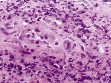 Figure 9-6.