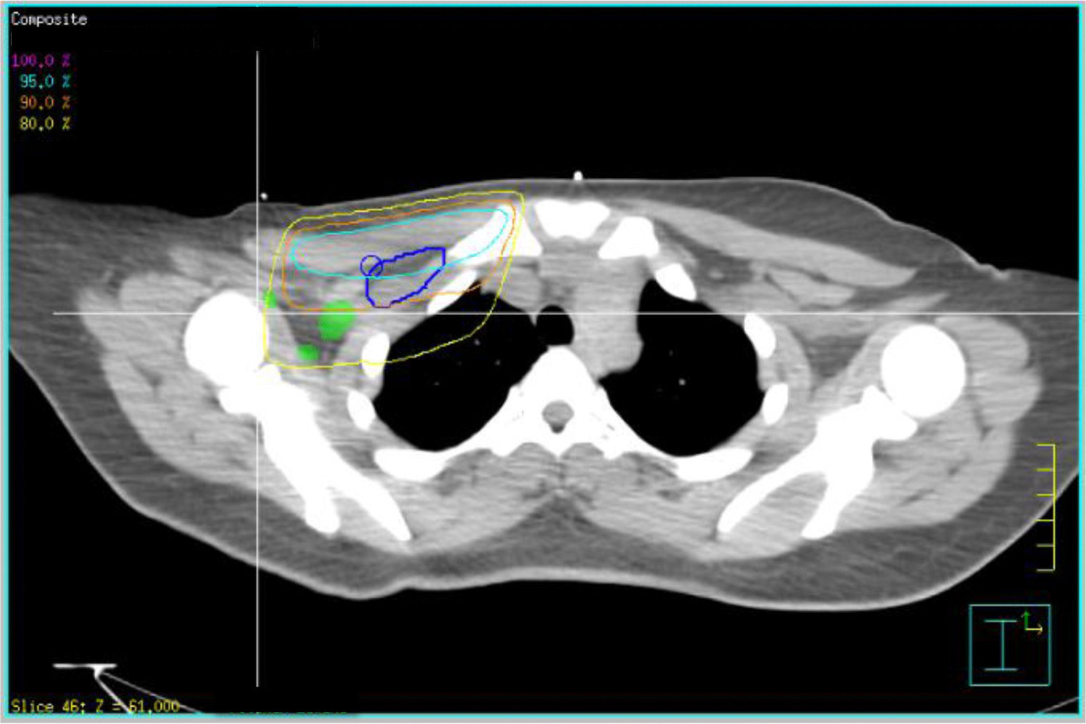 Fig. 3.