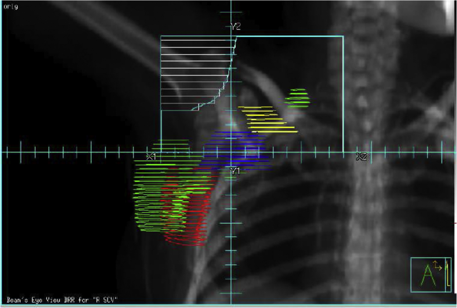 Fig. 2.