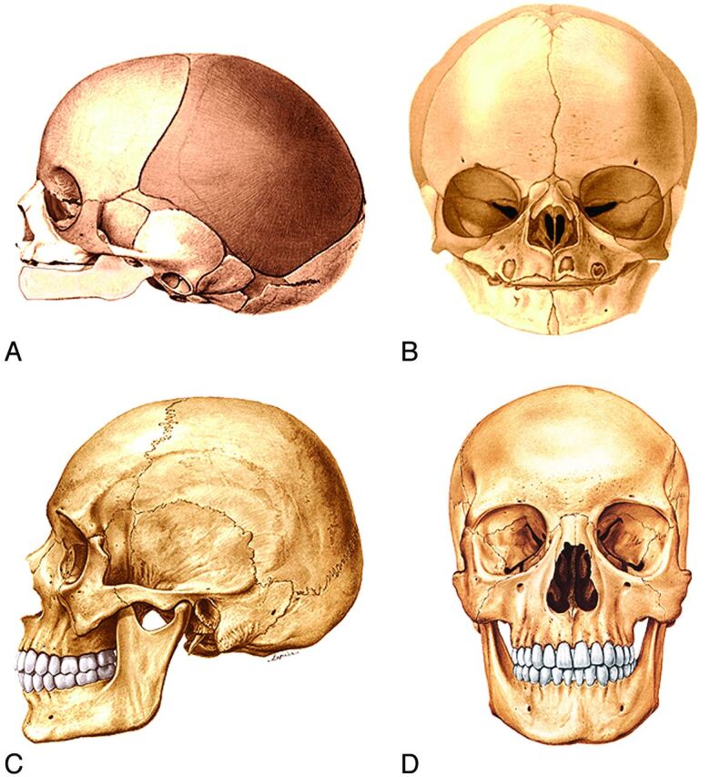 Fig 11.