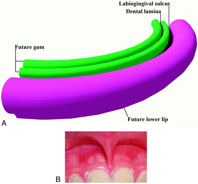 Fig 3.