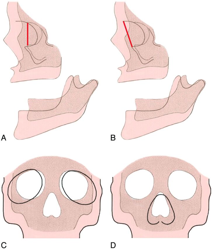 Fig 12.