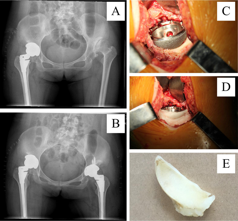 Figure 1A-E.