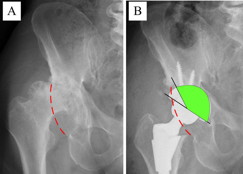 Figure 5A-B.