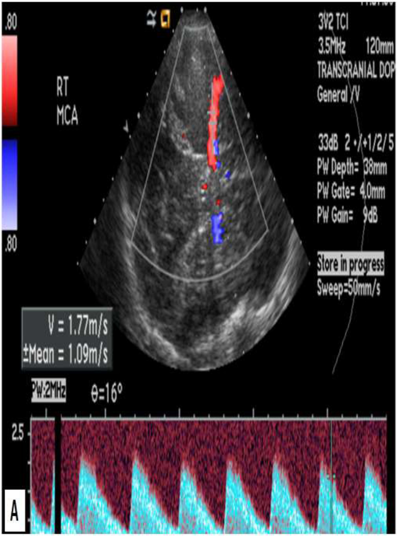 Figure 3: