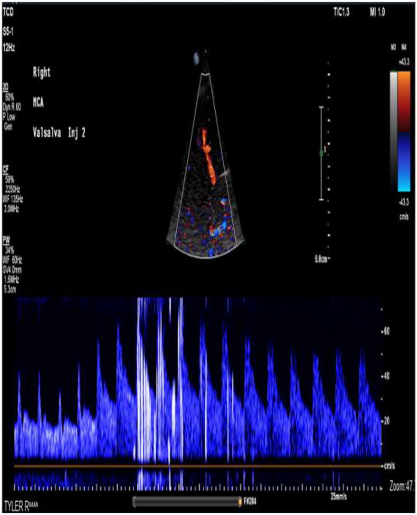 Figure 2: