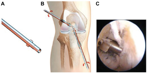 Figure 3.