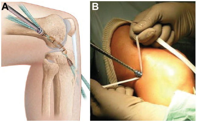 Figure 4.