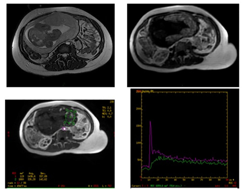 Fig 4