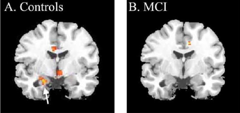 Fig. (7)