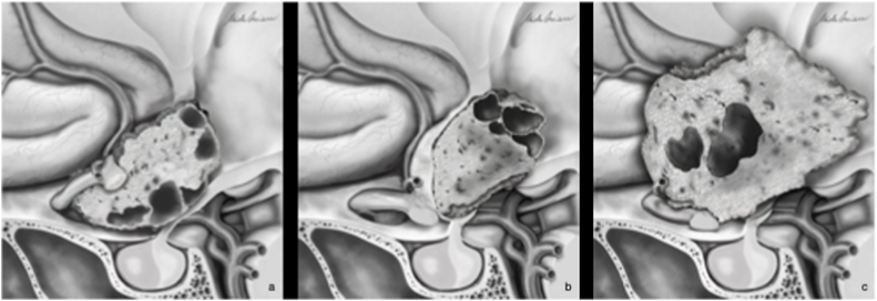 Fig. 4