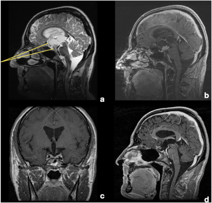 Fig. 3