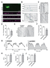 Figure 1.
<b>Diminished ROS levels decrease GLR-1 transport out of the cell body via a calcium-independent mechanism.</b>