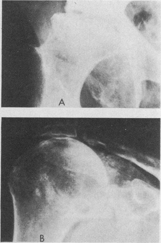 FIG. 8