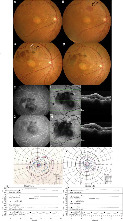 Figure 2