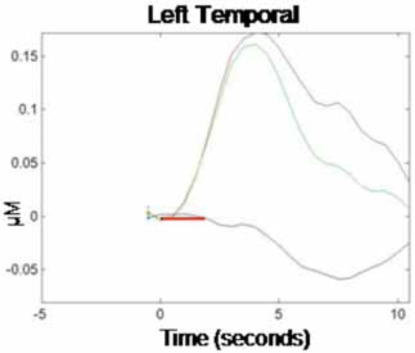 Fig. (1). Hemodynamic Response Function: Left temporal area (T3).