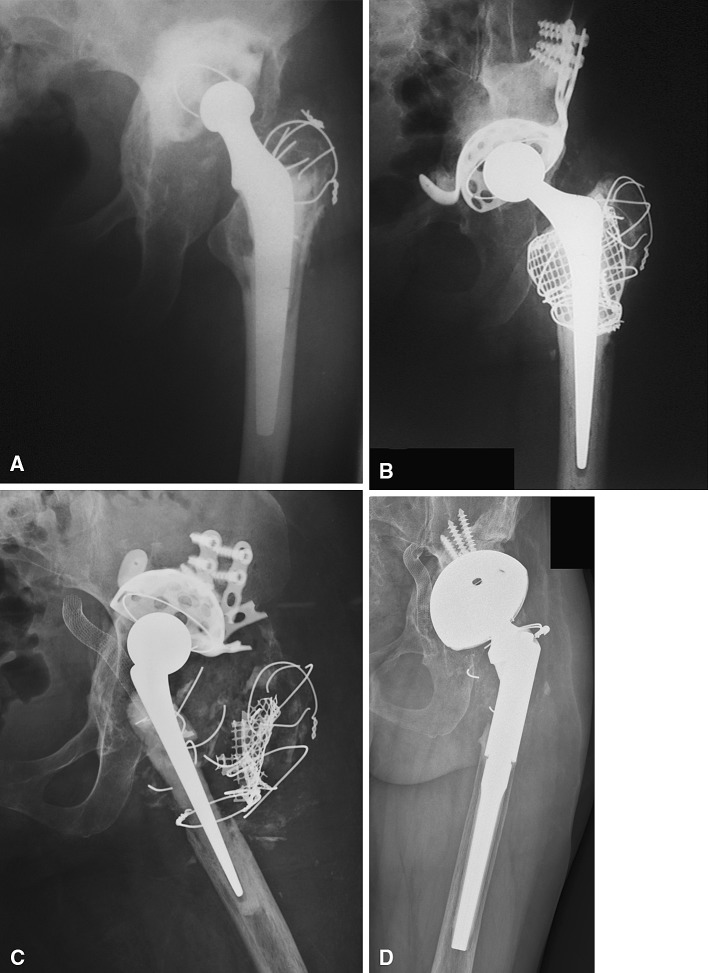 Fig. 2A–D