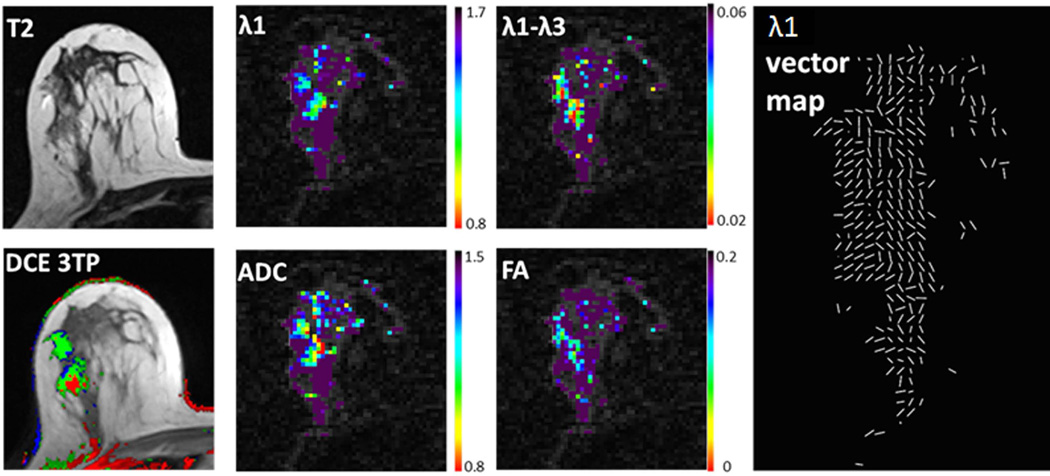 Figure 11