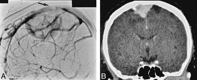 fig 2.