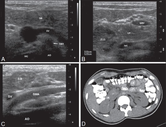 Figure 2 (A-D)