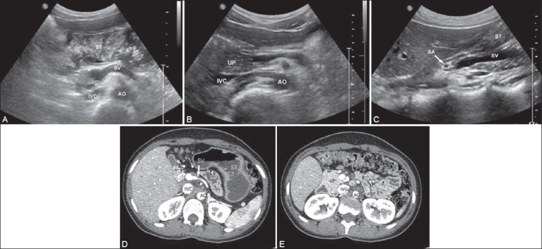 Figure 1 (A-E)