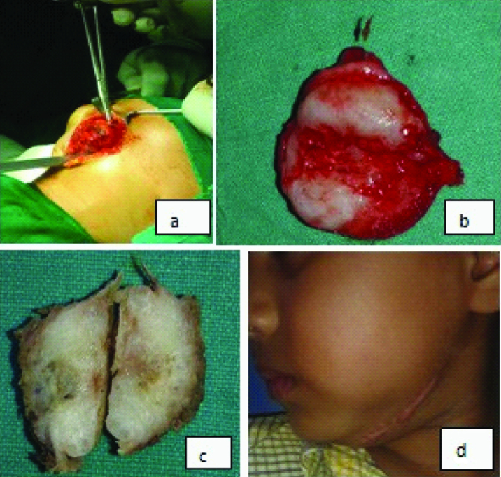 [Table/Fig-3]: