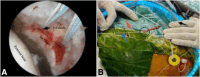 Fig 4
