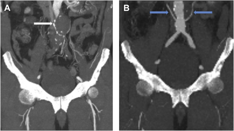 Fig. 1