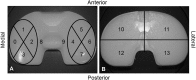 Fig. 2A–B