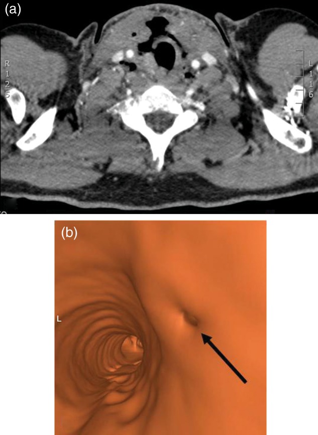 Figure 1: