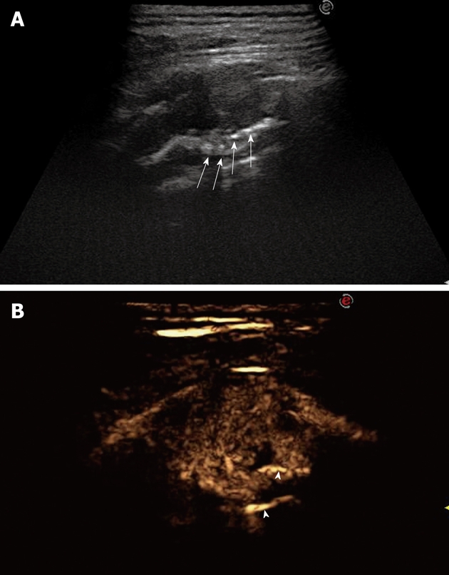 Figure 18